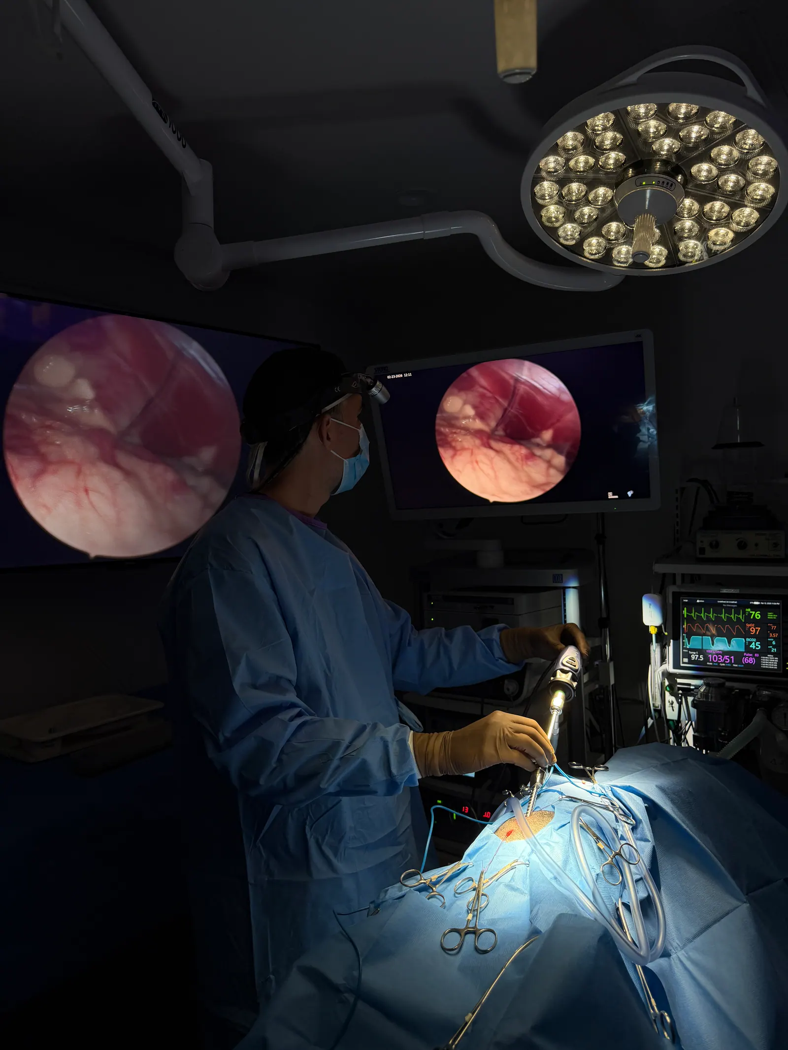 4K surgical monitor displaying a live laparoscopic procedure at our Los Angeles clinic